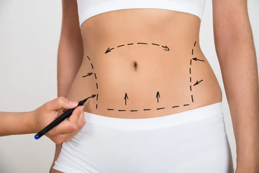 Abdomen