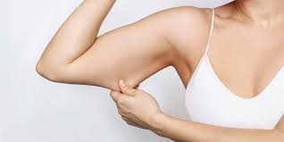 Tighten sagging arms