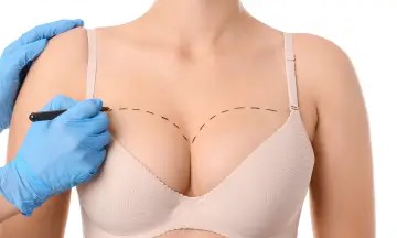 Treatment of gynecomastia in men